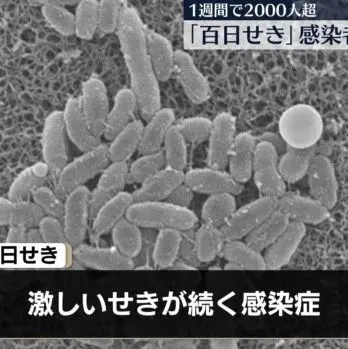 百日咳周感染人数2176人，超过2000人尚属首次，刷新历史最高纪录