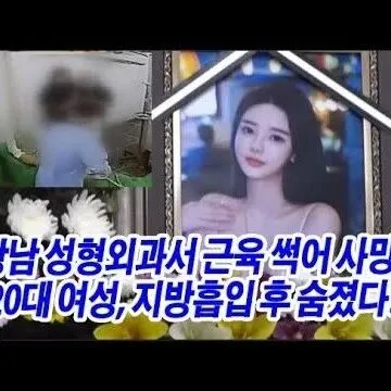 강남 <em>성</em><em>형</em><em>외</em><em>과</em> 참사 20대 여<em>성</em> 지방흡입 후 숨졌다 강남 <em>성</em>..
