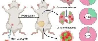 Nature | 南阿拉巴马大学西蒙·格雷莱特、古斯塔沃·阿亚拉团队揭示：癌细胞通过线粒体转移增强转移能力，神经系统助推癌症进展