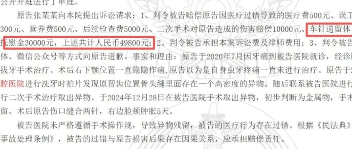 拔牙车针残留4年，索赔49800
