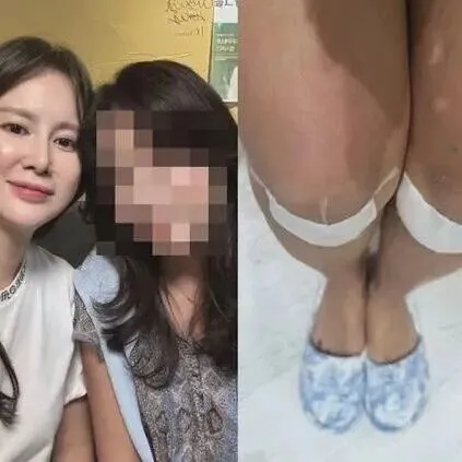 이혜원, 낙<em>상</em> <em>사</em>고 아찔…&안정환에 SOS "은퇴 이후 젤 빨리 뛰어" [ 해시태<em>그</em>]