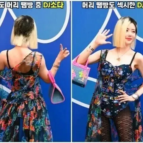 “머리 땜빵중” DJ소<em>다</em>, 더 이상 숨지 않아…“정면돌<em>파</em> 하겠<em>다</em>”