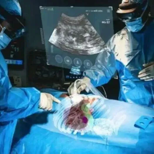 XR手术引导平台MediView完成2400万美元A轮融资