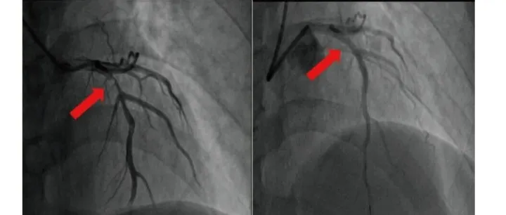 典型de <em>Winter</em>现象