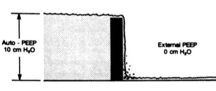 <em>auto</em>-PEEP、PEEP和“瀑布”模型
