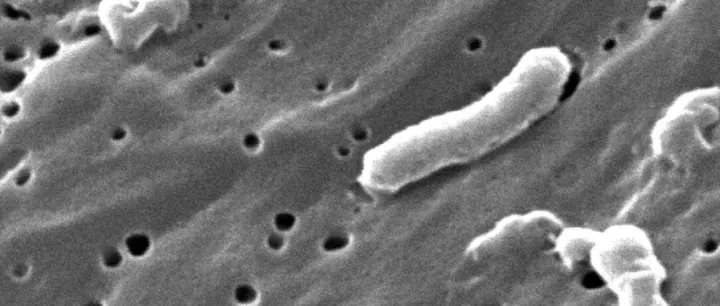 <em>美国</em>援助<em>冻结</em>重创全球霍乱防控