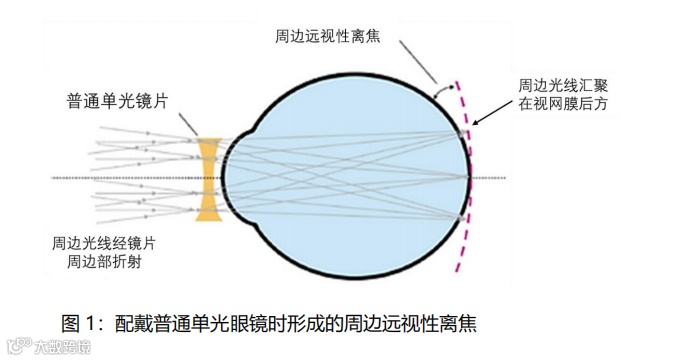 什么是对比敏感度多点离焦概念大扫盲_https://www.jmylbn.com_新闻资讯_第2张