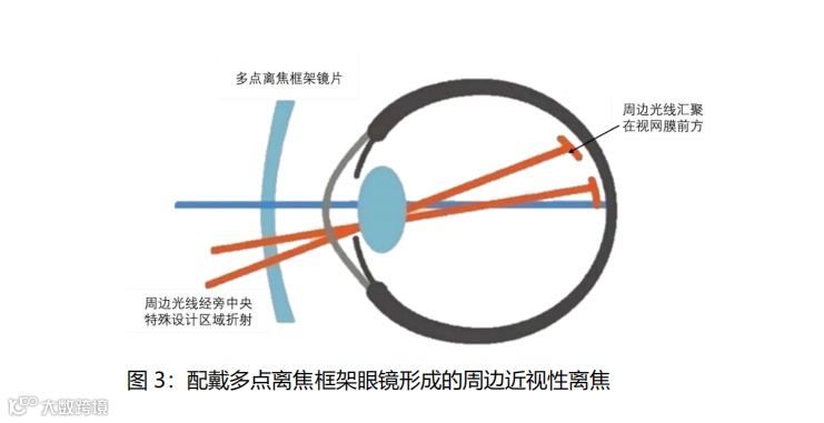 什么是对比敏感度多点离焦概念大扫盲_https://www.jmylbn.com_新闻资讯_第4张