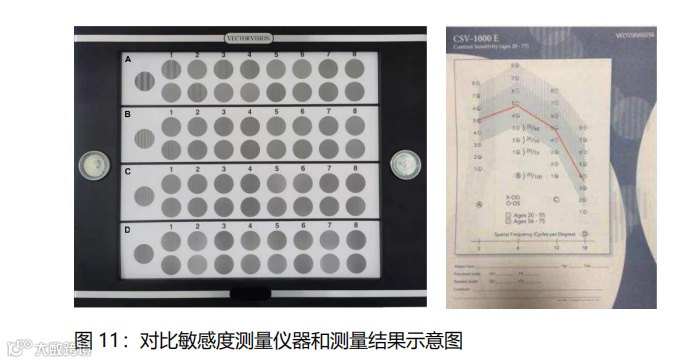 什么是对比敏感度多点离焦概念大扫盲_https://www.jmylbn.com_新闻资讯_第12张
