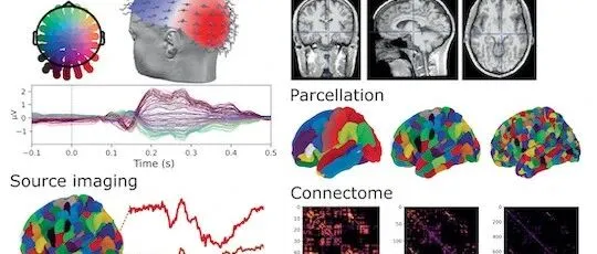 第二十一届脑电信号数据处理提高班（北京，11.21-25）