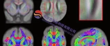 第十八届扩散磁共振成像提高班(南京，12.11-15）