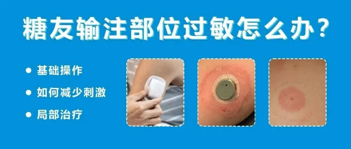 糖友输<em>注</em>部位过敏<em>怎么办</em>？