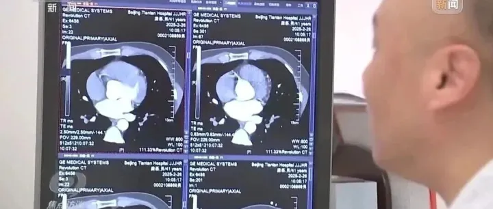新一代HIS.EMR智枢如何过“六级电子病历”？一抓住“数据的全量整合与智能应用”核心重点是关键！