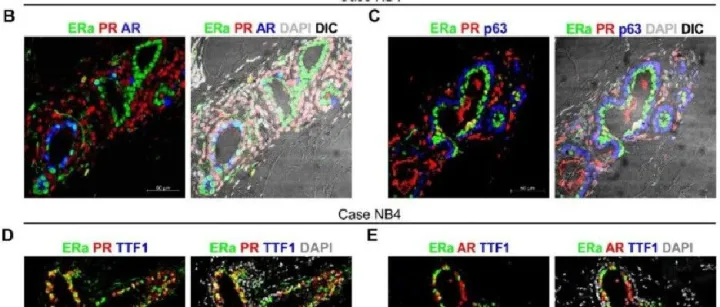 实验指南之多重荧光免疫组化（mIHC）