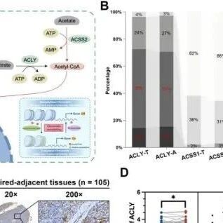Adv Sci丨复旦大学秦毅等人研究发现ACSS2和AATF在调节FasL表达方面具有非冗余和协同作用- 大数跨境