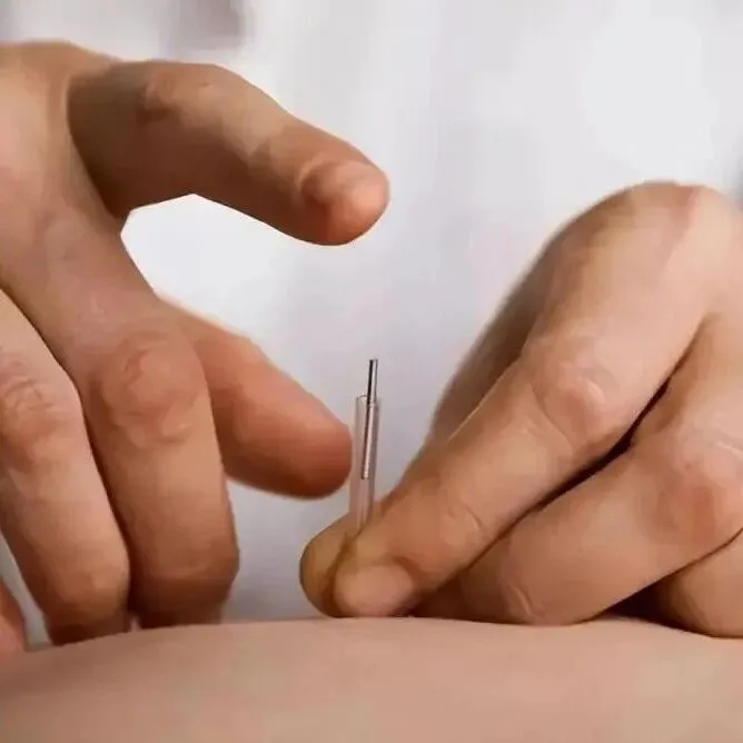 十二经脉之<em>穴</em>："井、荥、经、合、原、络、郄穴"+"特效<em>穴</em>"（针灸人必看）