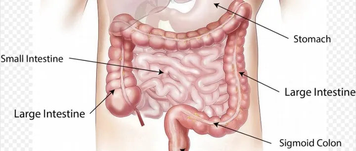 短程放疗（<em>SCRT</em>）序贯FOLFOXIRI巩固化疗作为局部晚期直肠癌（LARC）全程新辅助治疗（TNT）的II期研究