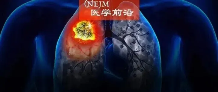 不可切除肺癌的治疗 | 综述