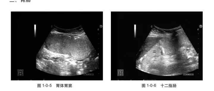 优秀的超声科医生，<em>报告书</em>写一定要规范！