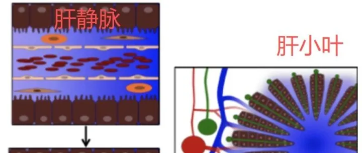 儿童造血干细胞移植科普系列（十八）：什么是造血干细胞移植后肝窦隙<em>阻塞</em>综合征？