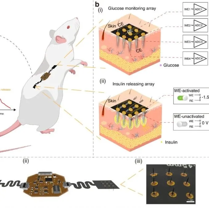 浙江大学开发可寻址微针阵列，用于血糖监测与胰岛素按需释放