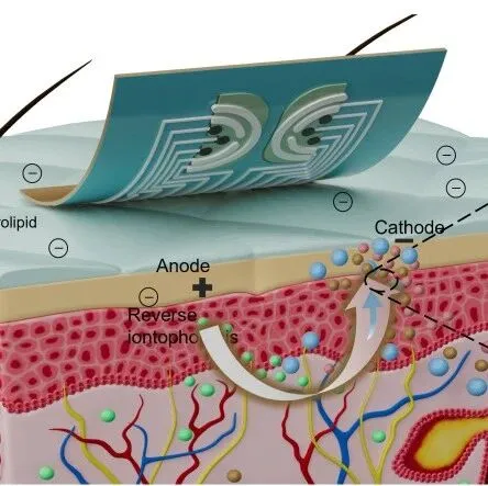 天津大学在非侵入式组织液生物标志物监测领域取得突破，推动可穿戴血糖监测走向临床应用