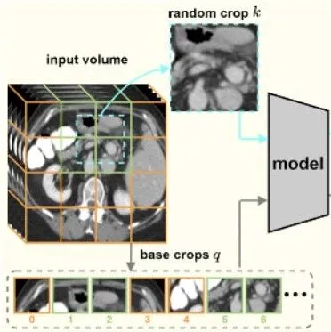 顶刊TPAMI 2025！港科大提出VoCo：医学3D视觉大模型
