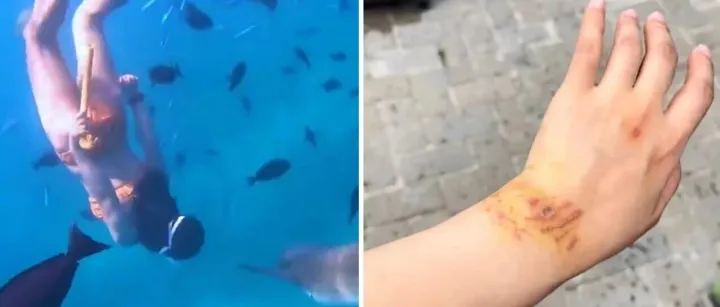 女网红生理期在马尔代夫潜水，为出片追鲨鱼时被咬伤！