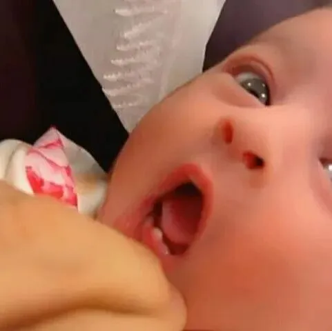 罕见：出生六天的沙迦女婴长出一颗完整牙齿令医生震惊