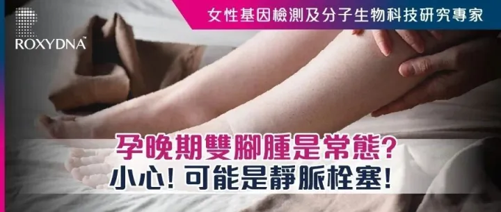 孕晚期雙腳腫是常態? 小心! 可能是靜脈栓塞