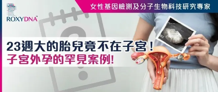 23週大的胎兒竟不在子宮，而是長在肚子裡!? —— 子宮外孕的罕見案例