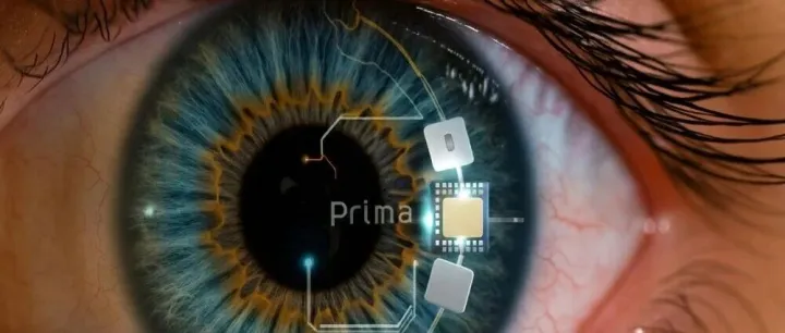 马斯克被反超：Neuralink前联创的人工视觉刚通过国际临床试验！