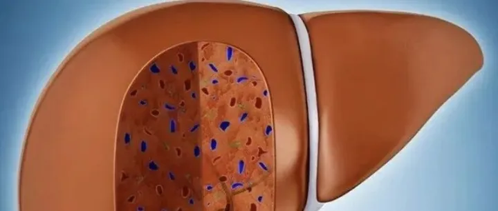 【化验单解读】谷丙转氨酶（<em>ALT</em>）：你的肝脏“报警灯”