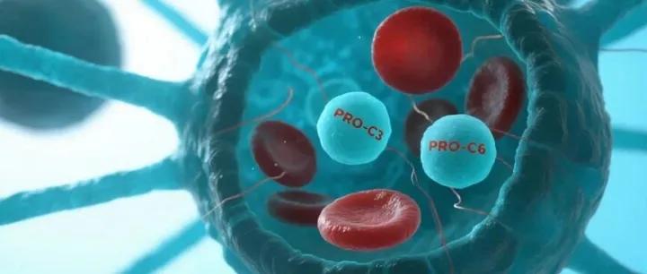 《Clinical and Experimental Rheumatology》新研究