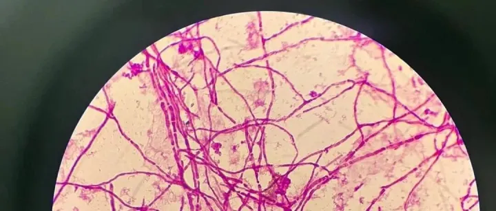 别再浪费质粒了！丝状真菌转化失败，80%都卡在这一步！