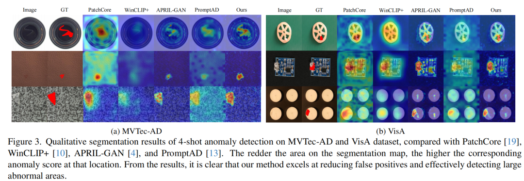 图3：不同方法的异常定位结果可视化对比