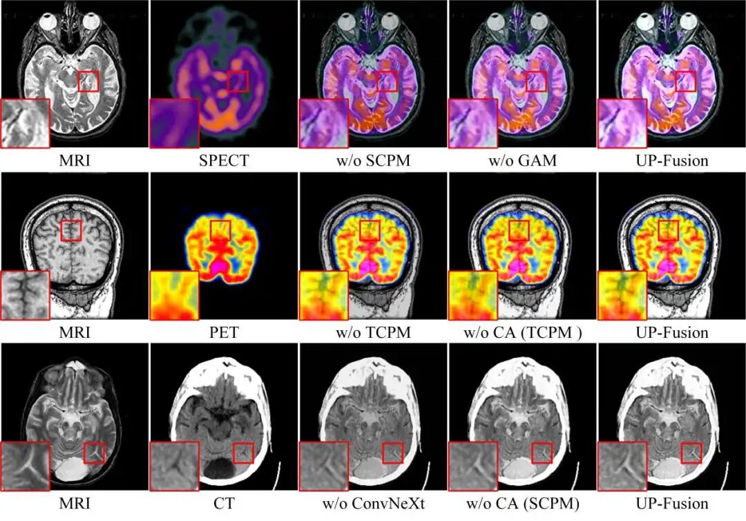 图9.消融实验视觉对比