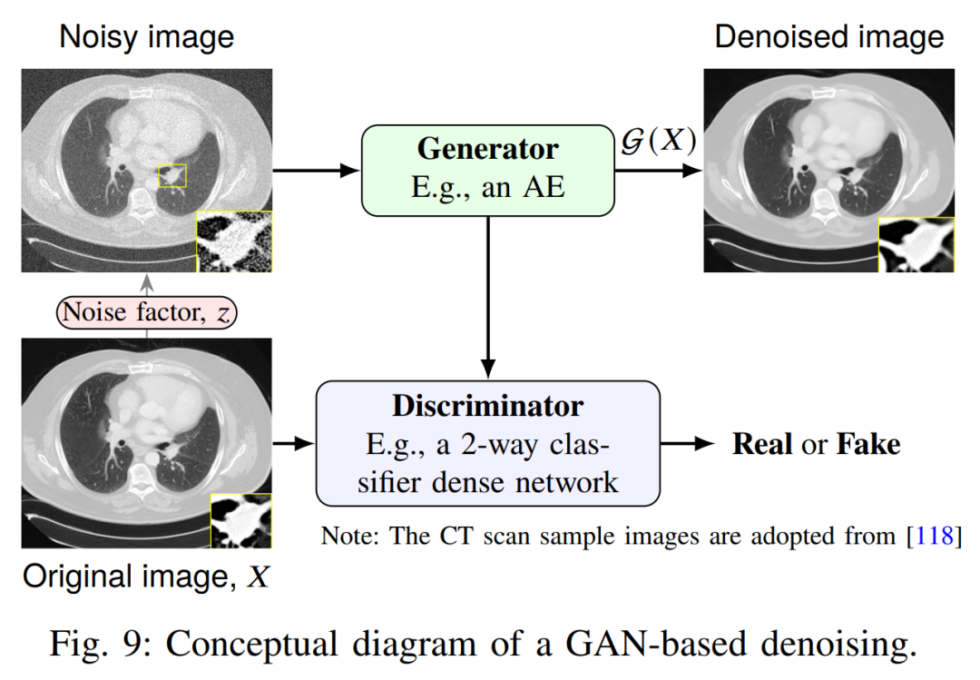 图9：基于GAN的去噪概念图