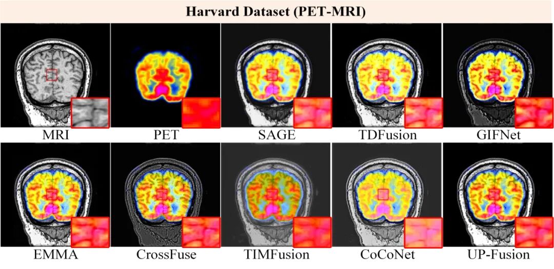 图8. 不同方法在PET-MRI上的融合结果
