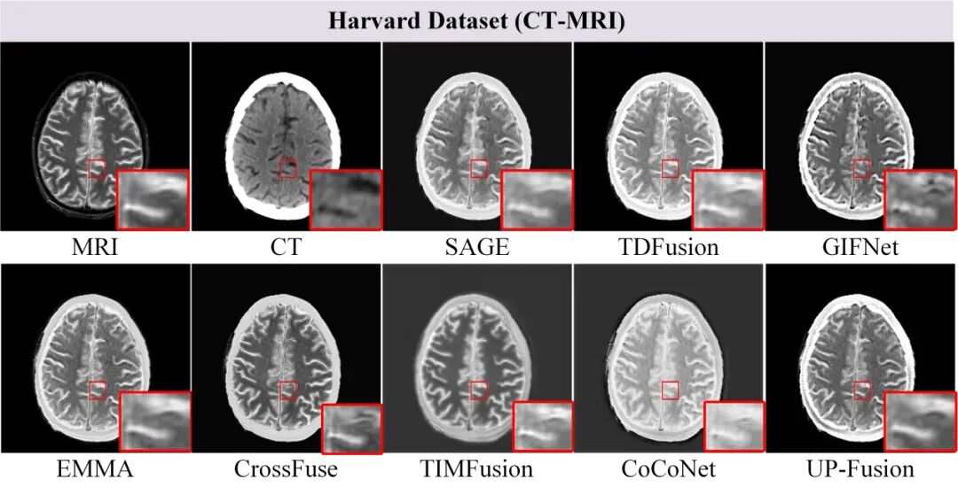 图6. 不同方法在CT-MRI上的融合结果