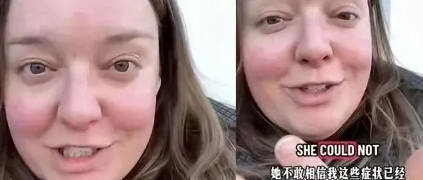 英国妹子胃疼「耗一年」？飞8000公里来中国就医「1天搞定」！