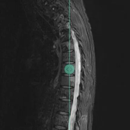 颠覆传统影像采集！这款 AI 软件获 FDA 批准，零耗时生成诊断级影像