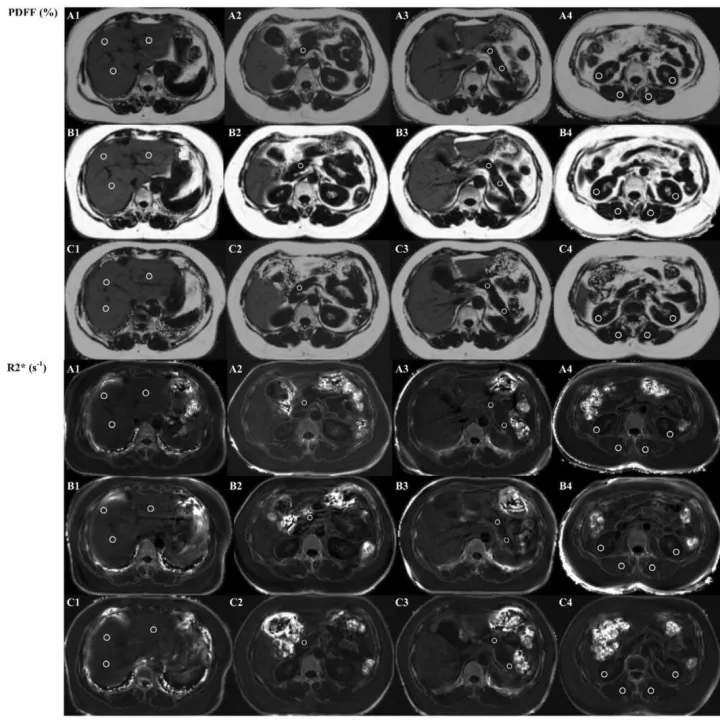 联影5T MRI 2025年第二季度科研成果回顾