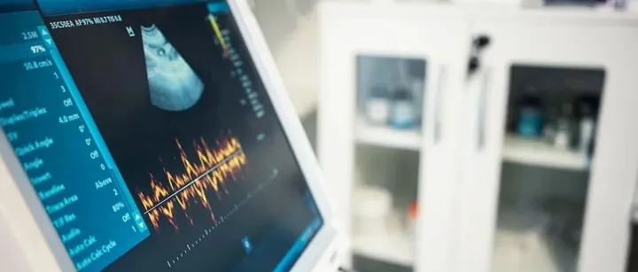 双语学习｜B超的“B”到底是什么意思？