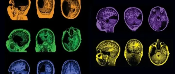 Check our latest Featured Articles!