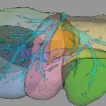 星云工作站肝脏分析软件