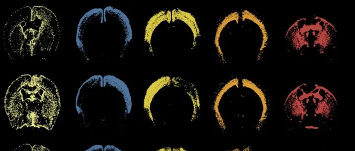 Nature ｜ 耶鲁大学樊荣院士揭示脑发育和神经炎症的空间动力学