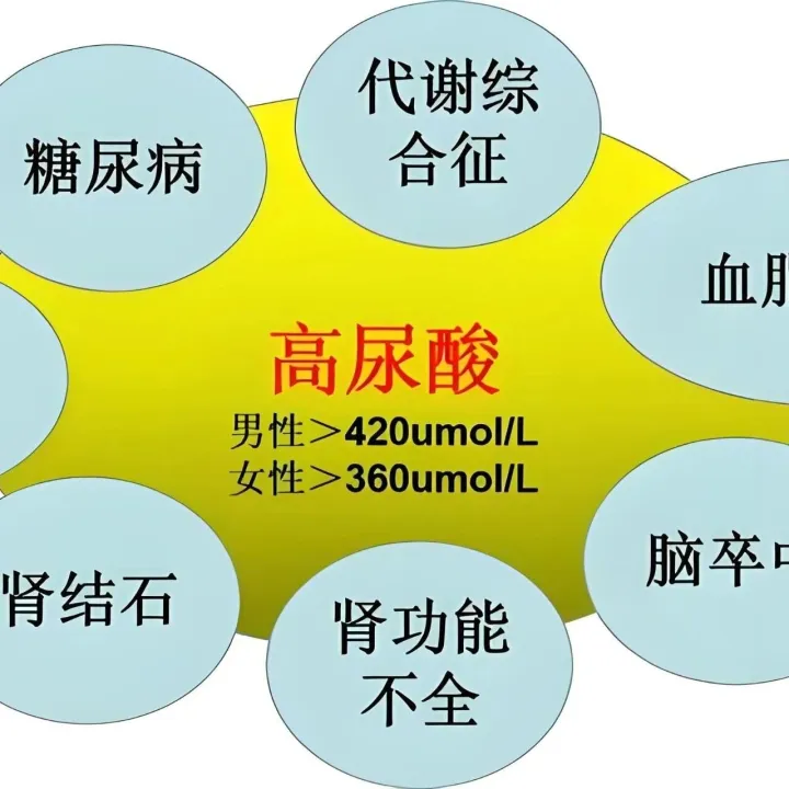 高尿酸<em>是</em><em>怎么</em>来<em>的</em>？