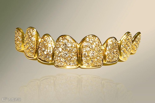 4-套镶钻金牙.png