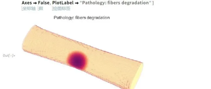 从核磁共振到模型：基于 Wolfram 语言的计算机模拟医学